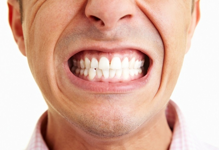 Как остановить бруксизм (скрежет зубами или сильное сжатие)?