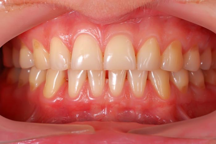 показаны зубы и десны